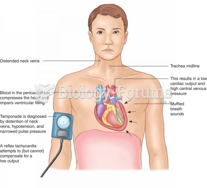 Physical Findings of Cardiac Tamponade