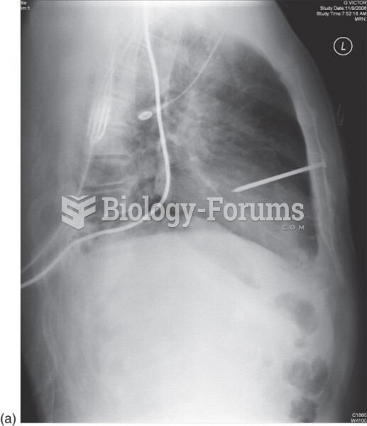 Penetrating Trauma to the Heart (Nail) as Seen on Lateral Chest X-Ray