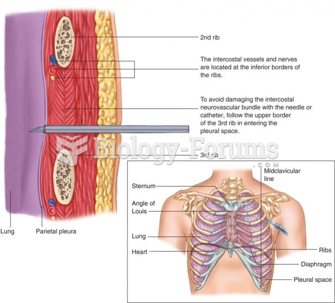 Needle Decompression of a Tension Pneumothorax