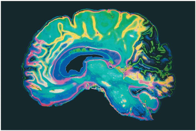 Opener A colorized cross section of the human brain