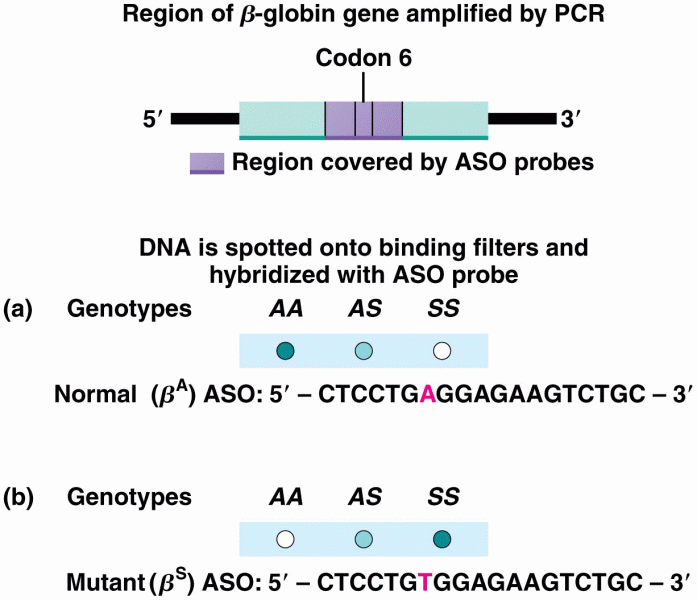 Allele-specific oligonucleotide (ASO) testing for the -globin gene and sickle-cell anemia