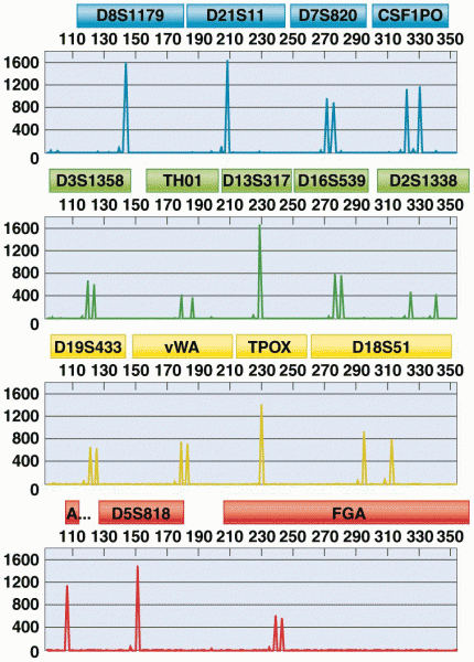 An electropherogram showing the results of a DNA profile analysis