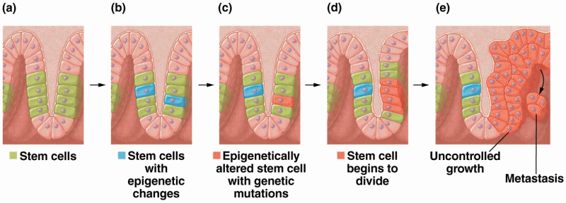 The epigenetic stem cell model proposes that both epigenetic changes