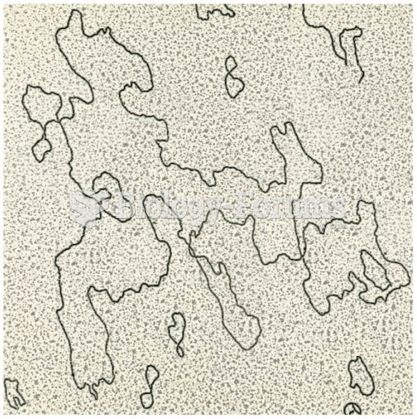 An electron micrograph of chloroplast DNA (cpDNA) derived from lettuce