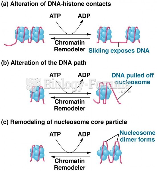 Three ways by which chromatin remodelers