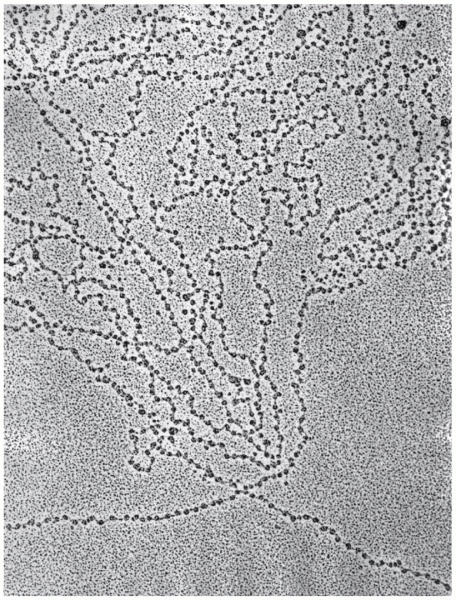 n electron micrograph revealing nucleosomes appearing as “beads"