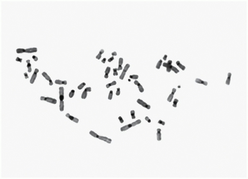 A human mitotic chromosome preparation processed 