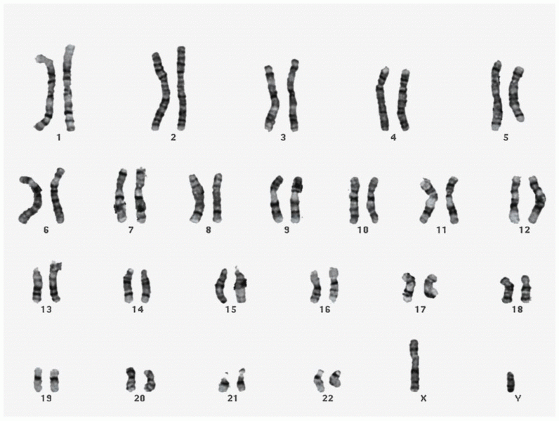 G-banded karyotype of a normal human male