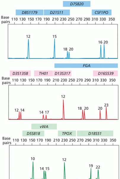 An example of DNA profile results for the 13 original CODIS STRs