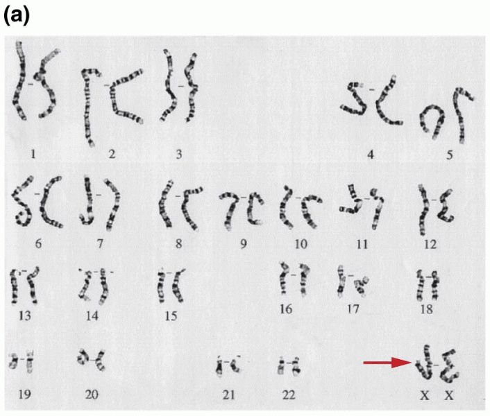 The traditional human karyotypes derived from a normal female and a normal male