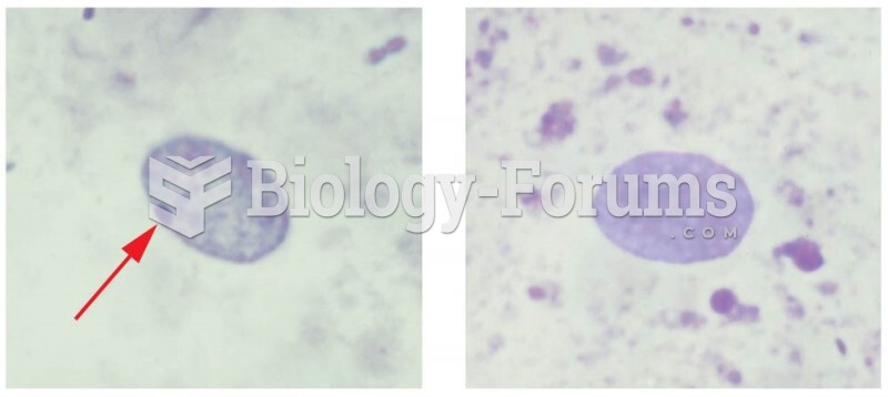 Photomicrographs comparing cheek epithelial cell nuclei 