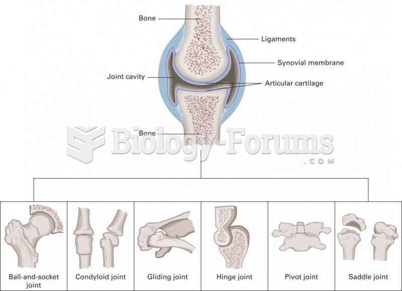 Types of Synovial Joints