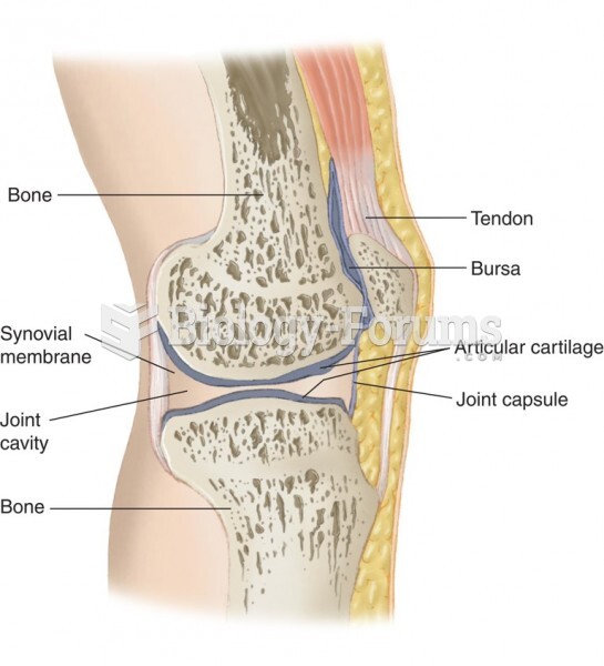 Structure of a Joint