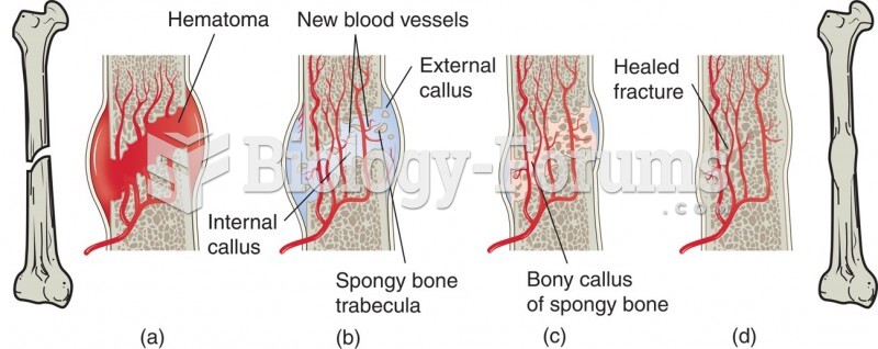Bone Healing. The Bone Repair Cycle. Presentation of a Forearm Fracture