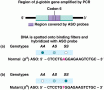 Allele-specific oligonucleotide (ASO) testing for the -globin gene and sickle-cell anemia