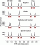 Electropherogram showing the STR profiles of four samples from a rape case