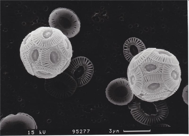 Emiliania huxleyi cells in an electro-microscopic picture.