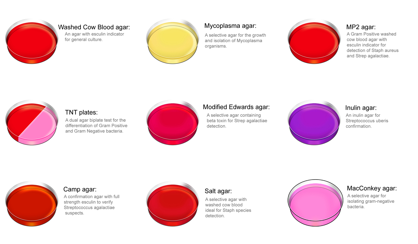 Types of selective media