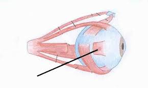 Lateral rectus