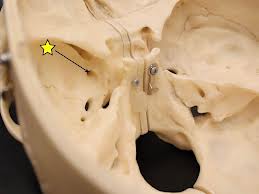 Foramen Rotundum