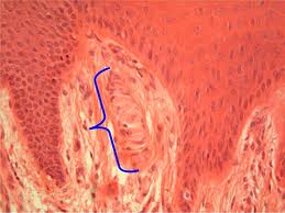 Meissner's corpuscle