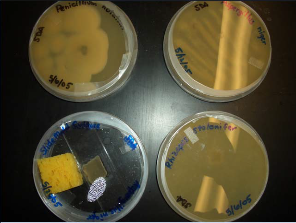 Different Fungi in Petri Dishes