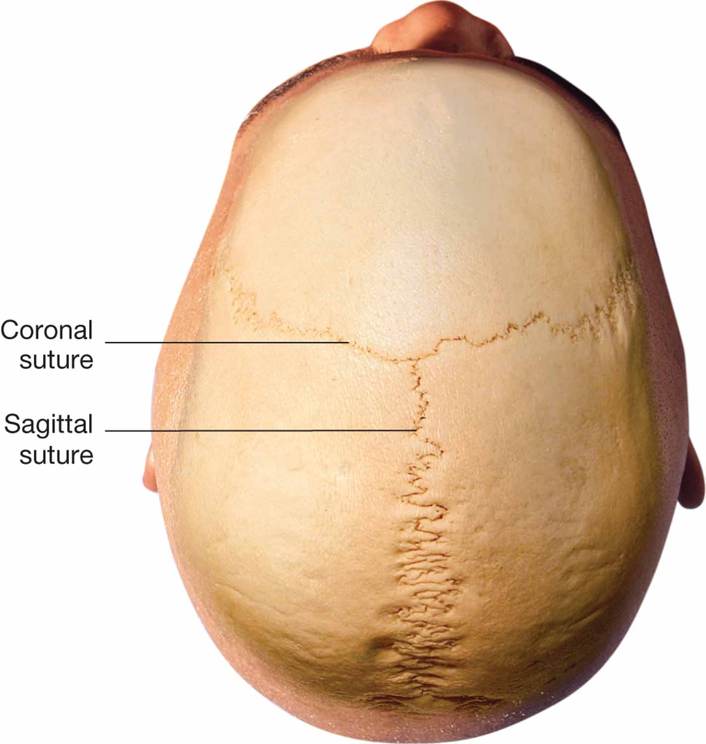 Suture joint.