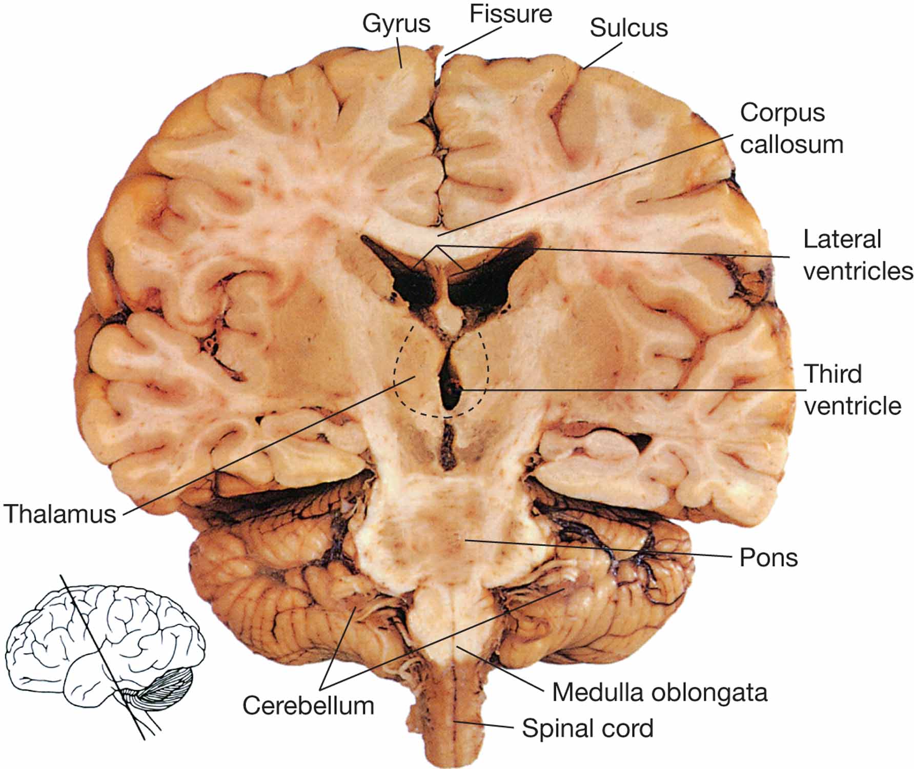 Posterior half of the brain.