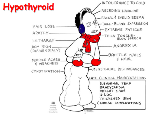 Hypothyroidism