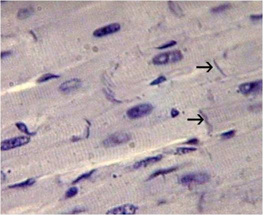 Intercalated disc