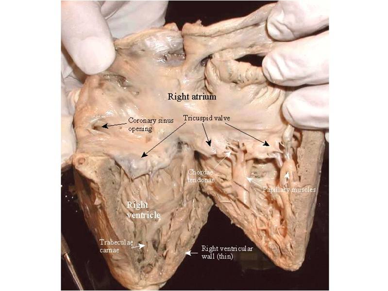 Trabeculae carneae (folds of muscle in ventricle)