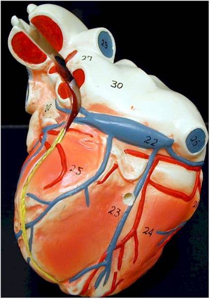 Coronary sinus