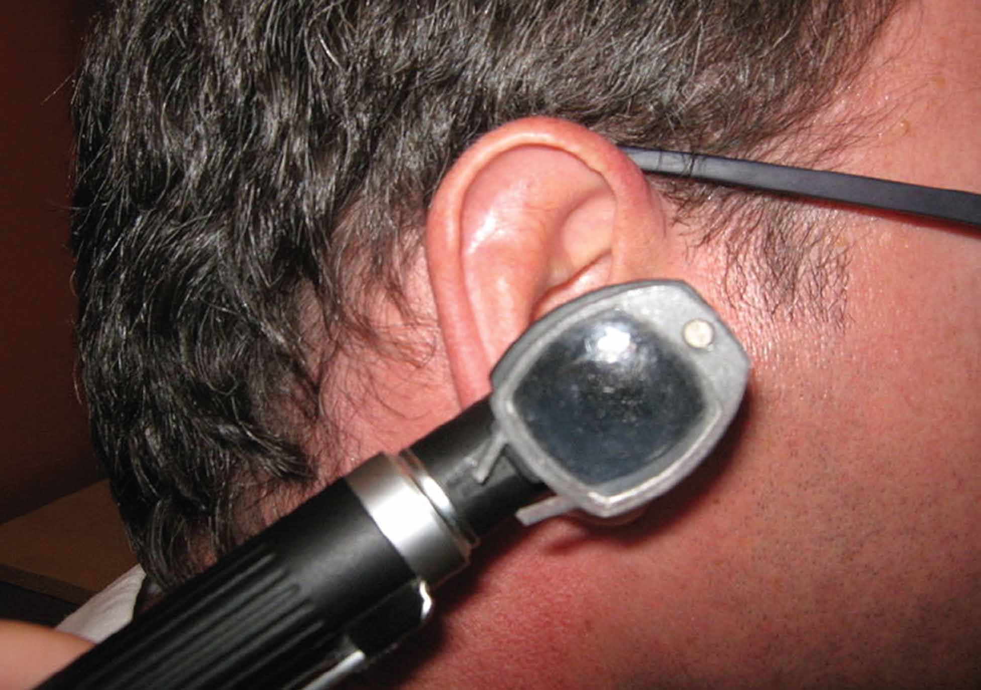 The otoscope is positioned in the ear prior to examination of the auditory canal.