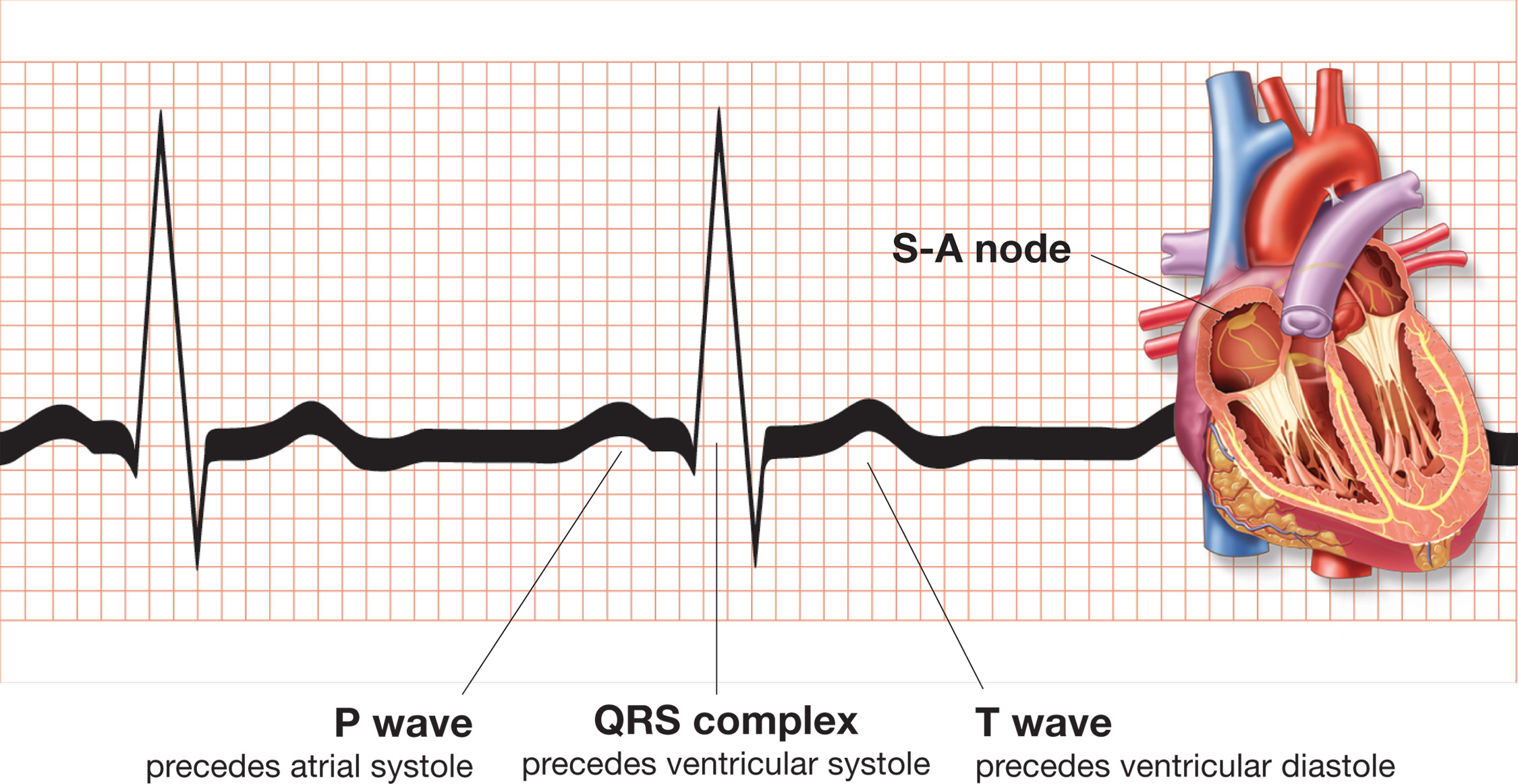 An electrocardiogram (EKG) wave, a record of the electrical signal as it moves through the conductio