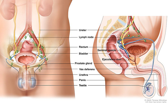 Cancer of testis