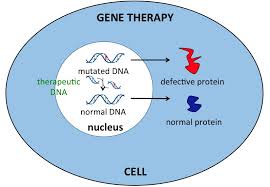 Gene therapy