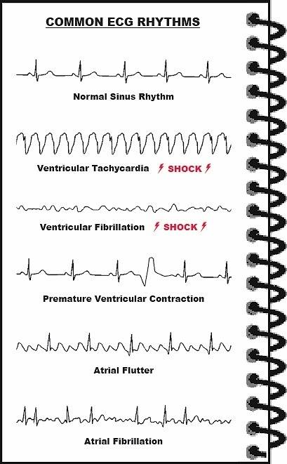 ECGs