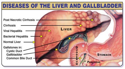 Diseases and Effects on Liver