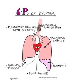 Dyspnea