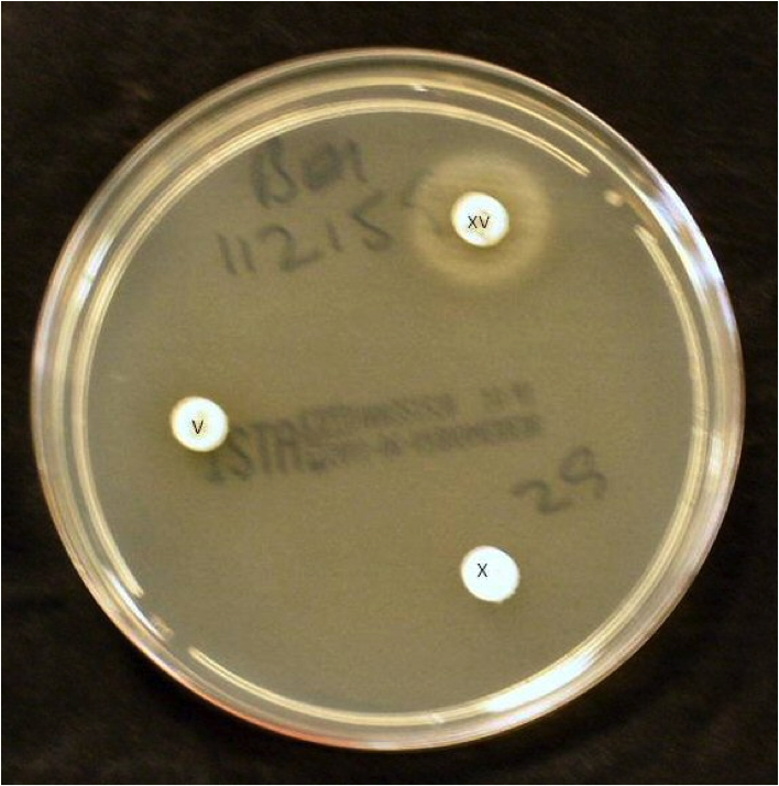 Nutrient Agar