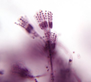 Penicillium-conidospores