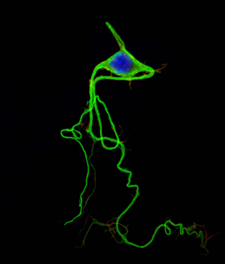 Neuron from Chicken embryo