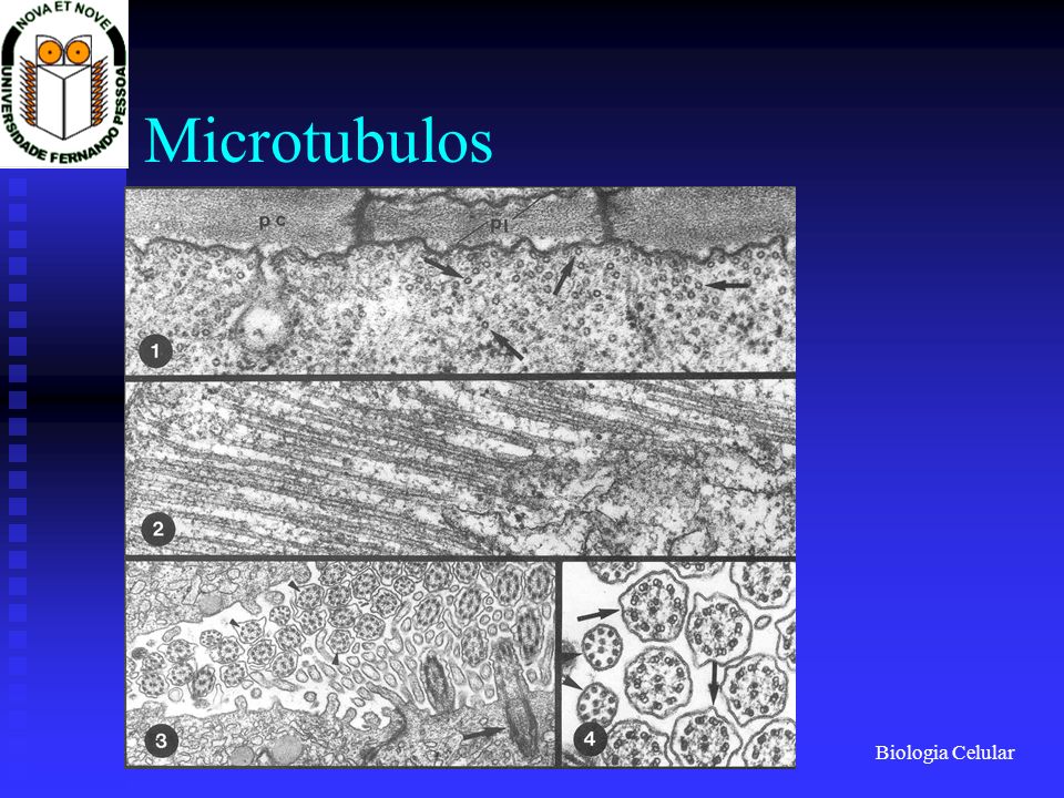 Microtubulos