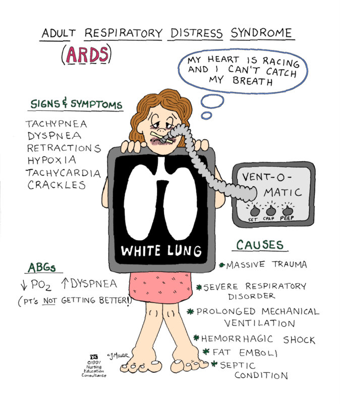 Adult Respiratory Distress Syndrome