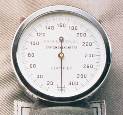 An Aneroid Sphygmomanometer Dial