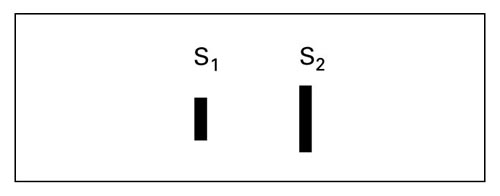 Summation of Heart Sounds, Variable S1