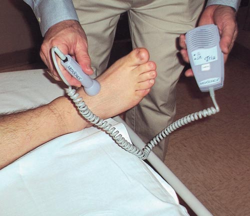 Use of an Ultrasonic Stethoscope to Detect a Dorsalis Pedis Pulse