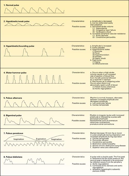 Alterations in Arterial Pulses