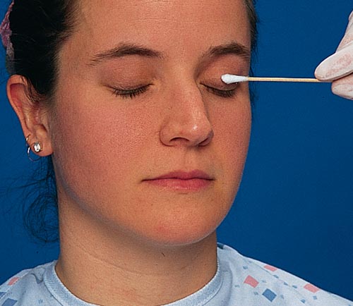 Assessing Palpebral Conjunctiva, Everting the Eyelid