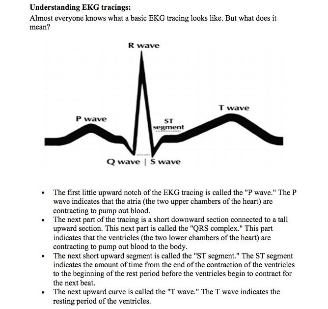 Understand ECGs